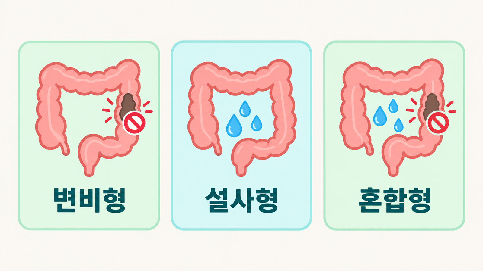 복통 위치와 변비형·설사형·혼합형 체크리스트