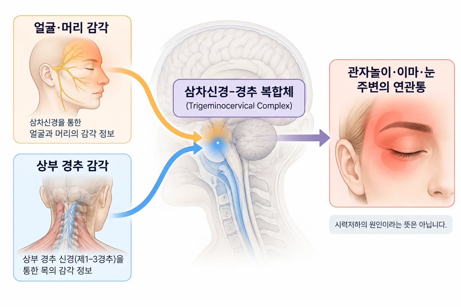 얼굴과 상부 경추의 감각 신호가 합류하는 삼차신경-경추 복합체 개념도